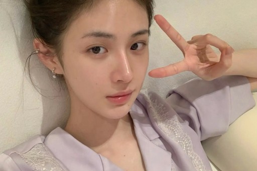 孙菲菲揭娱乐圈霸凌声援李玟!自曝被吐浓痰殴打致毁容打人者仍嚣张没被抓